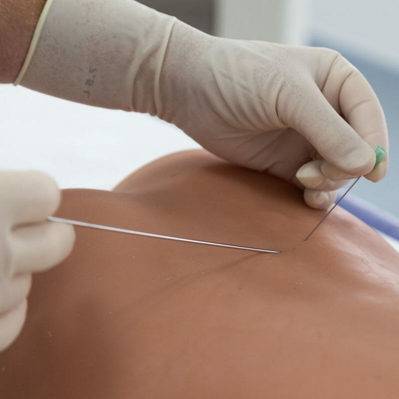 การรักษาโดยวิธีอินเตอร์เวนชั่น (Spinal intervention pain management)