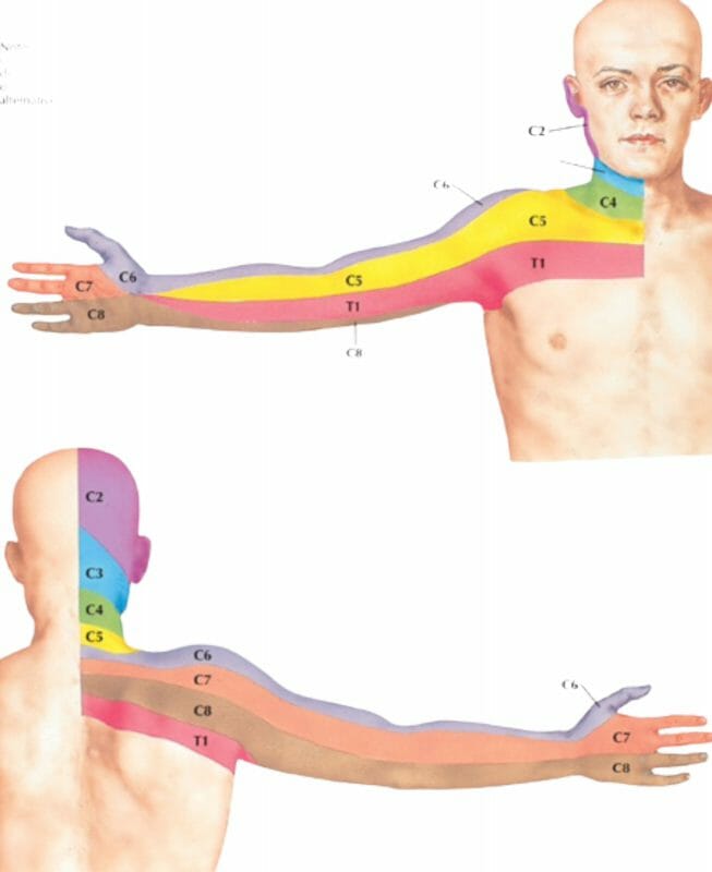 หมอนรองกระดูกคอทับเส้นประสาท-8