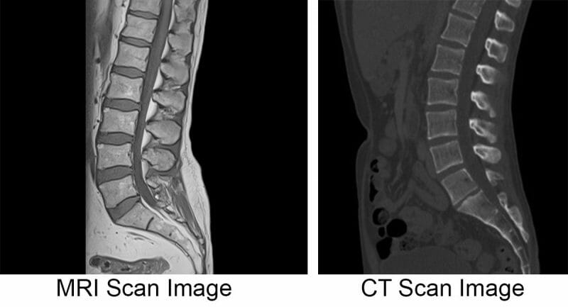 izen imaging mri ct scan usg xray interventions