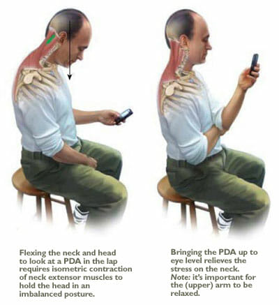 ทำยังไงดี? ใช้มือถือนานๆแล้วปวดคอ texting posture - ทำยังไงดี? ใช้มือถือนานๆแล้วปวดคอ