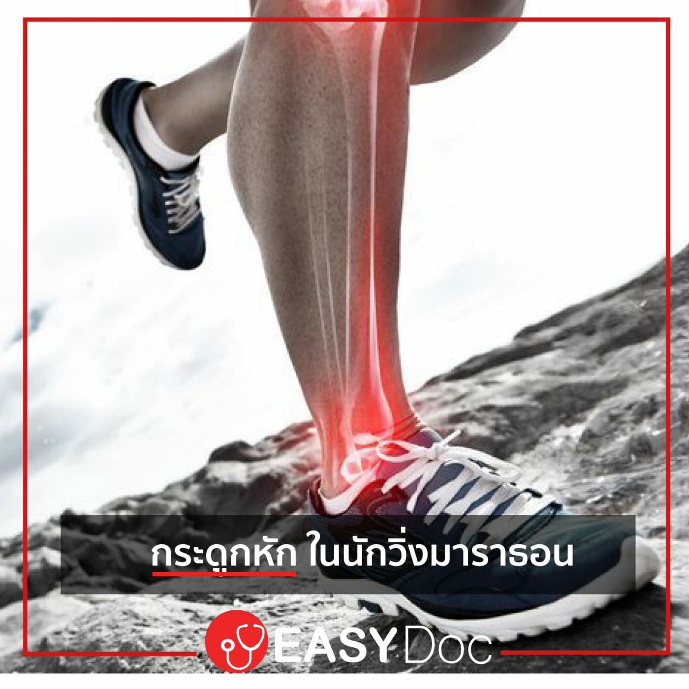 กระดูกหัก-นักวิ่งมาราธอน กระดูกหัก-นักวิ่งมาราธอน
